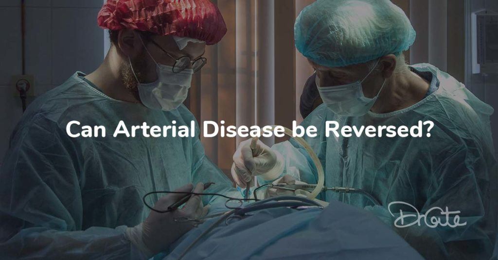 Can Arterial Disease be Reversed?