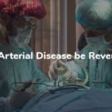 Can Arterial Disease Be Reversed?