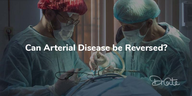 Can Arterial Disease Be Reversed?