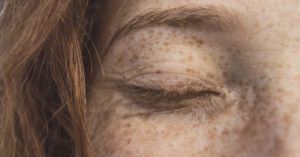 Anti-aging