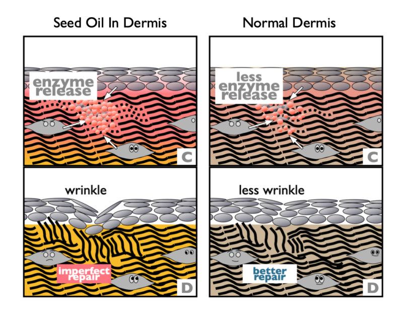 Seed oils damage collagen in your skin